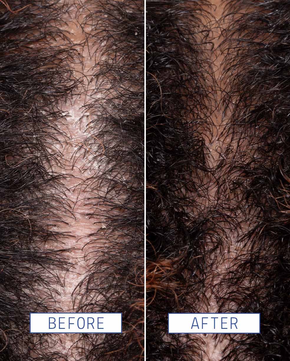 Scalp detox jelly cleanser