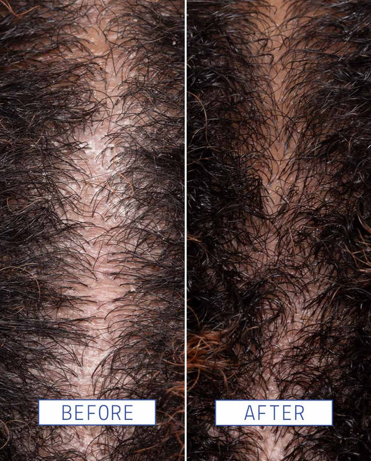 Scalp detox jelly cleanser