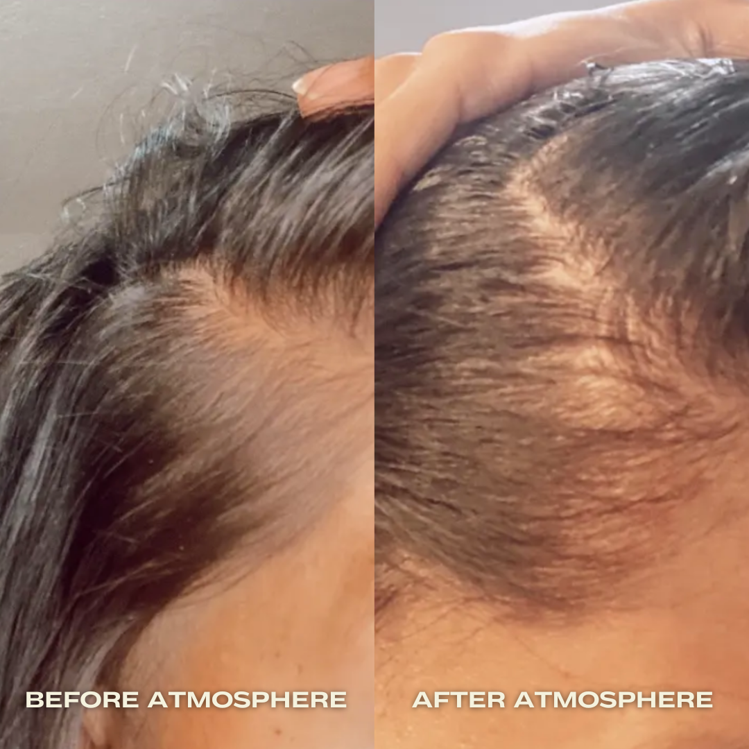 Atmosphere Hair Density & Scalp Serum