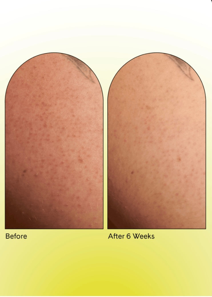 KP Body Scrub