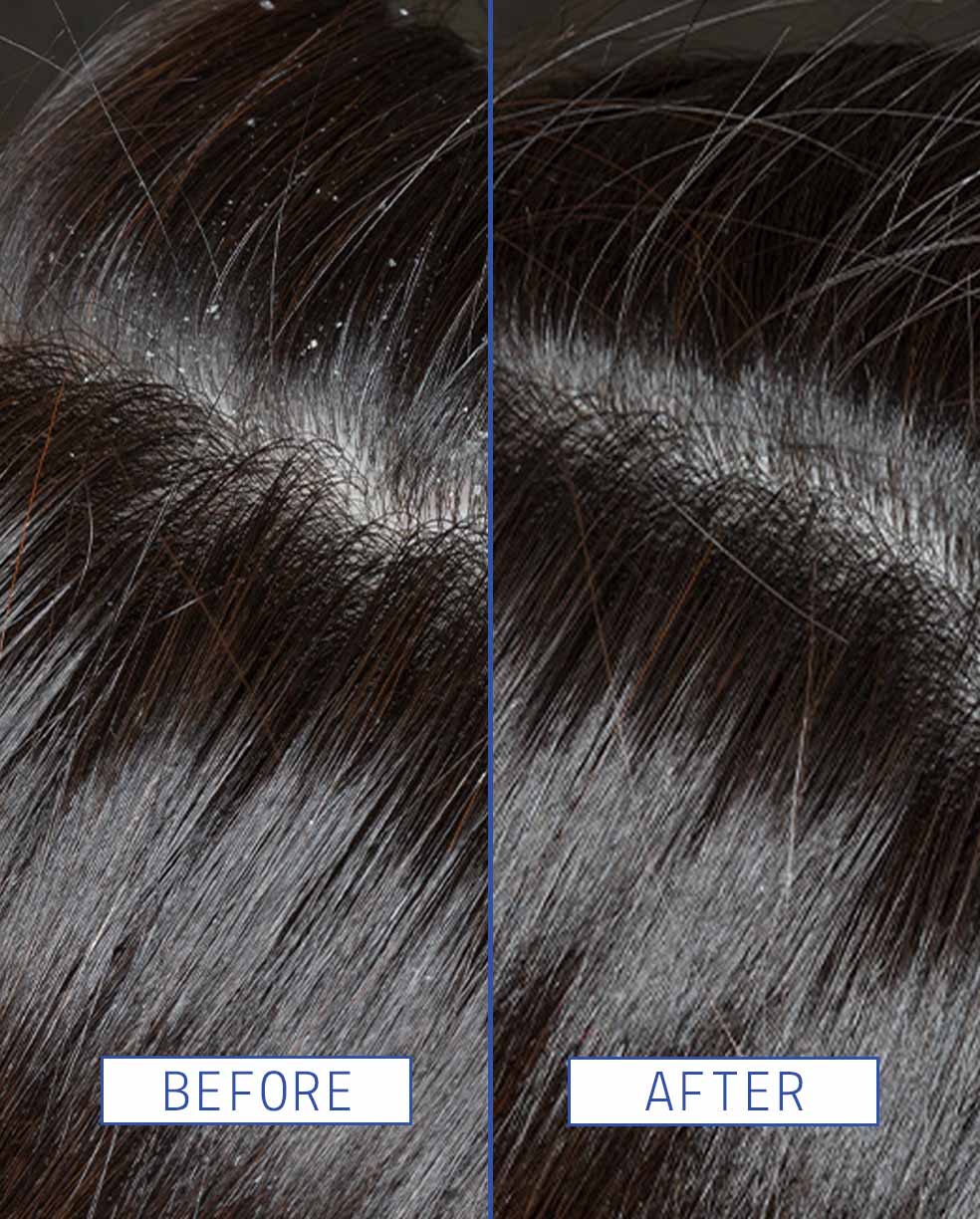 Scalp Rescue Serum
