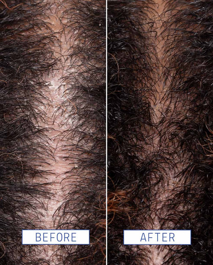 Scalp detox jelly cleanser