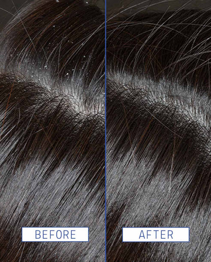 Scalp Rescue Serum