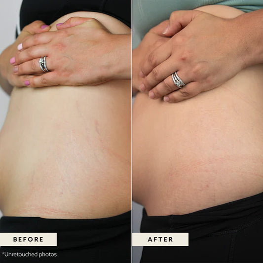Unconditional Care Body Butter
Resilience & Recovery